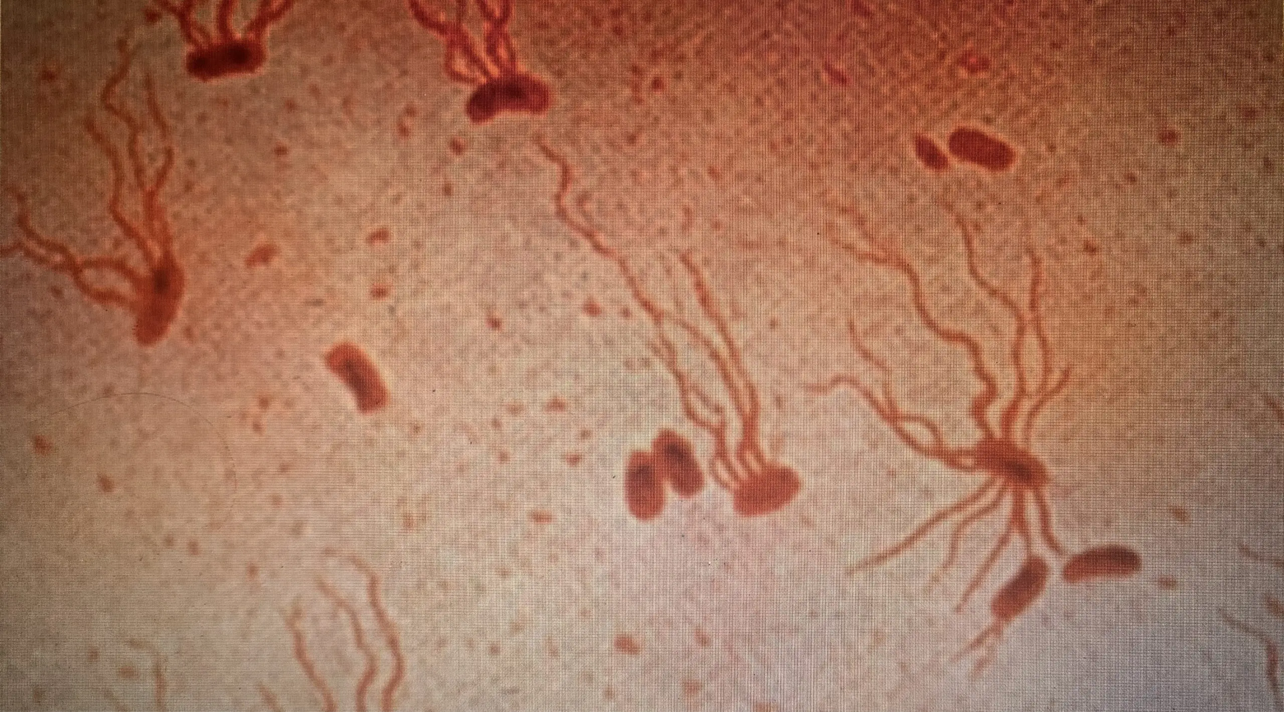 Salmonella penyebab tipes